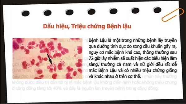 Dấu hiệu của bệnh lậu