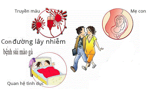 Những con đường lây nhiễm sùi mào gà